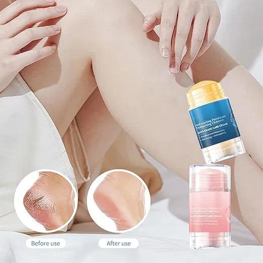 Cracked Skin Repair Cream, Winter Anti-Cracking Frost, Vegan Foot Cream for Dry, Rough and Cracked Feet, Protects and Binds Moisture, Foot Care Cream
