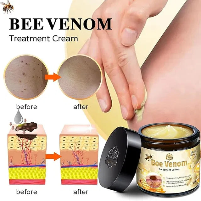 Zidella Skin Lighting Blemish Cream (50 g)